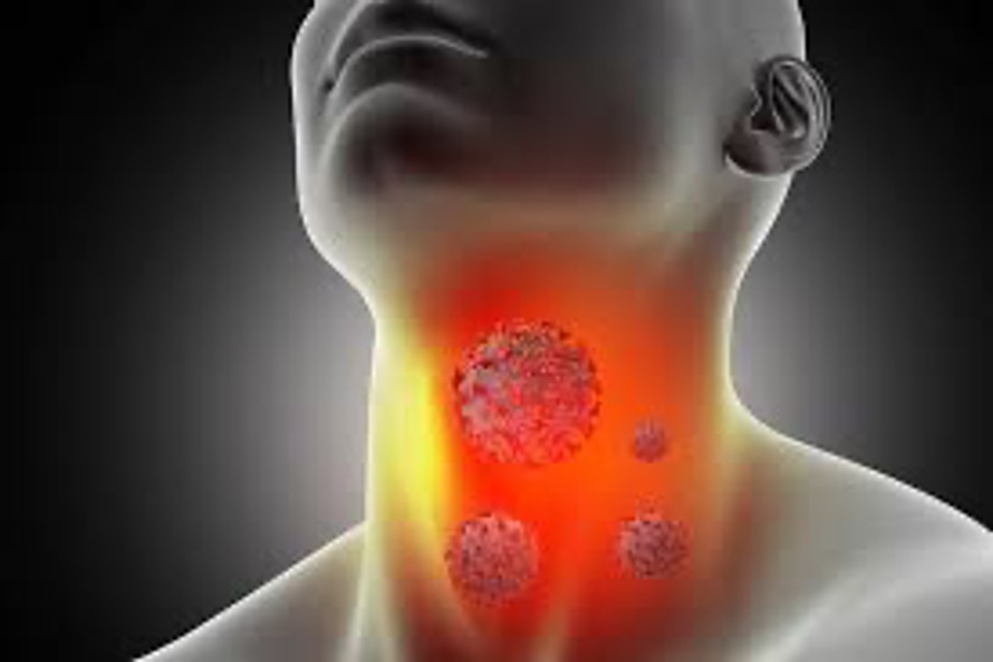 Ung thư vòm họng điều trị thế nào?
